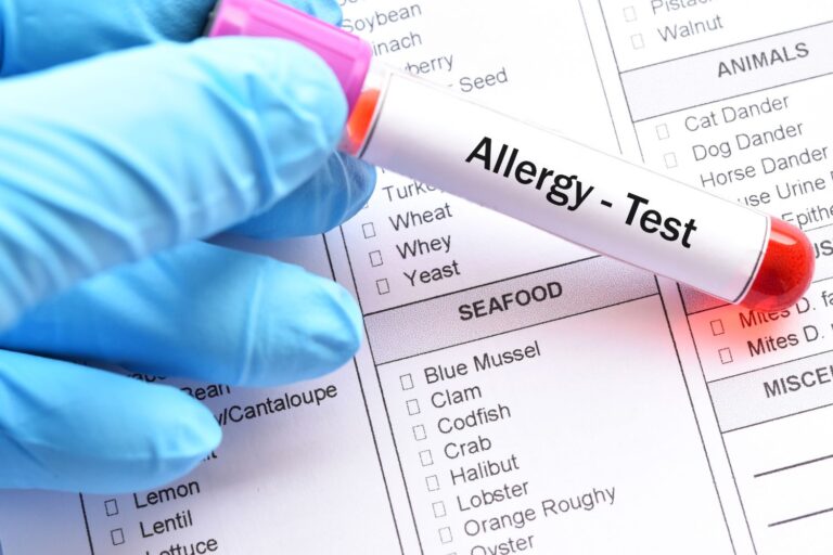 allergie alimentari test sangue bambin gesù