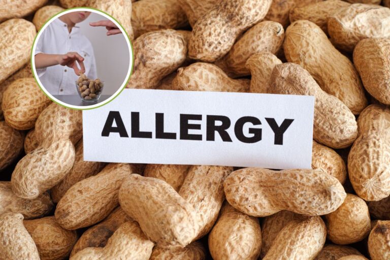 allergia arachidi