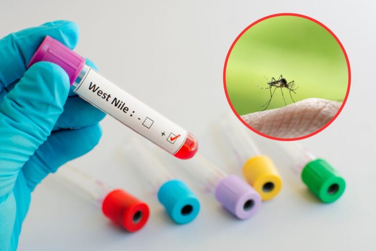 Eerste dood van de Nijlkoorts in Lazio: de symptomen die niet moeten worden onderschat, hoe het virus en de kaart van de besmettingen te verzenden
