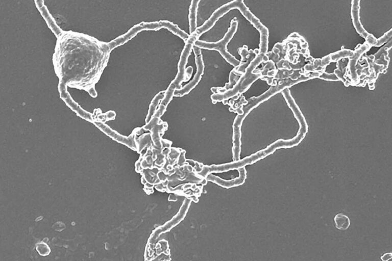 Asgard archaea