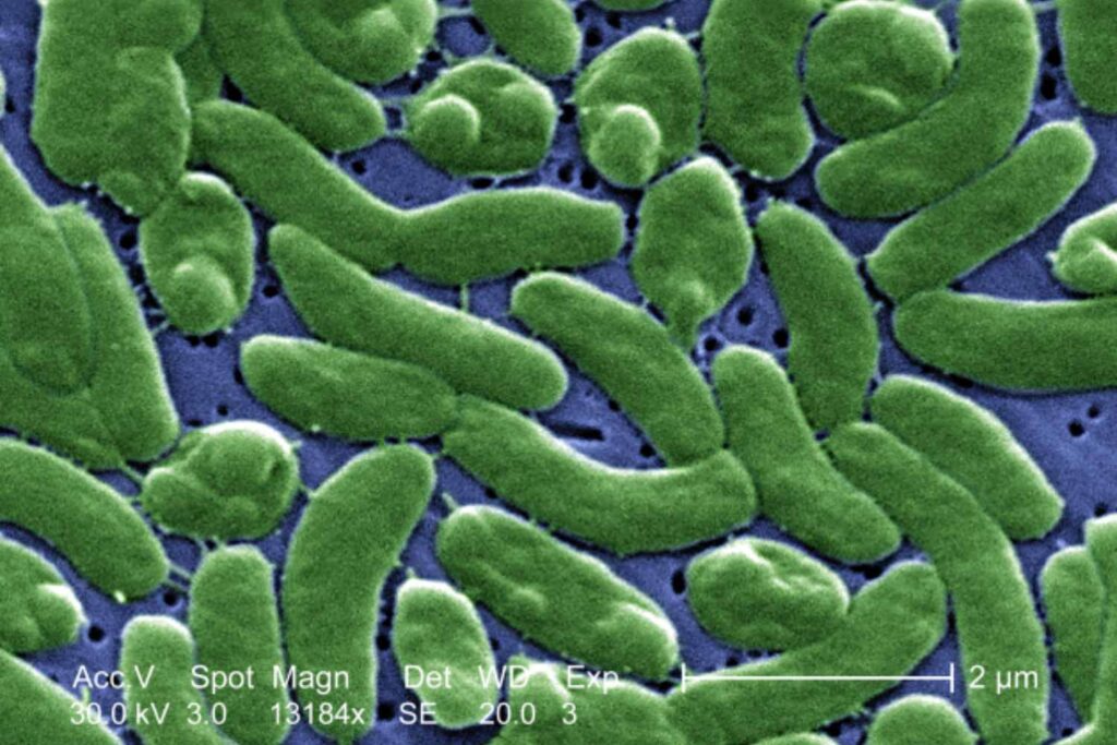 Nu de zee steeds warmer wordt, vermenigvuldigt de gevreesde ‘vleesetende’ bacterie zich: de klimaatcrisis stelt zichzelf bloot aan nieuwe infecties