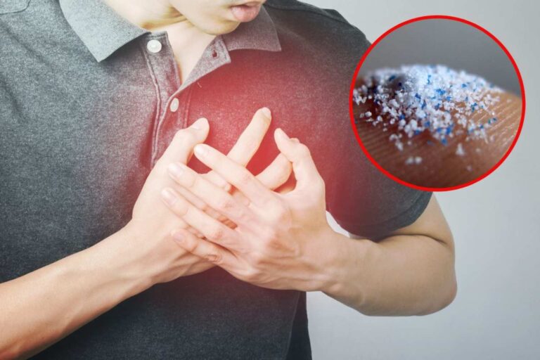 microplastiche infarto